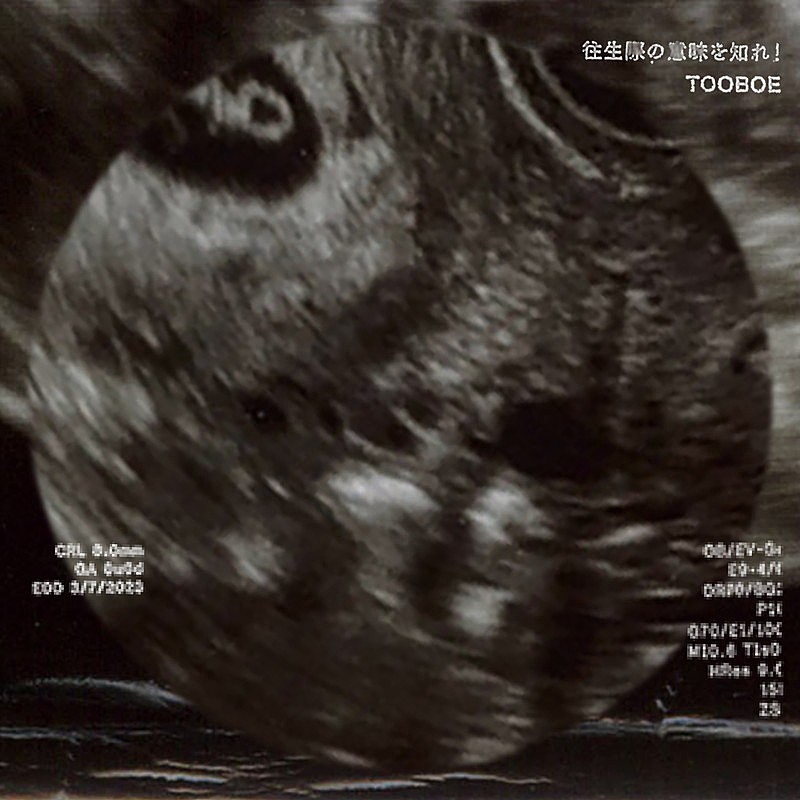 「	TOOBOE 配信シングル「往生際の意味を知れ！」」2枚目/3